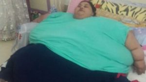 Maxi intervento di chirurgia bariatrica per una donna che pesa 500 kg Eman Ahmed Abd El Aty
